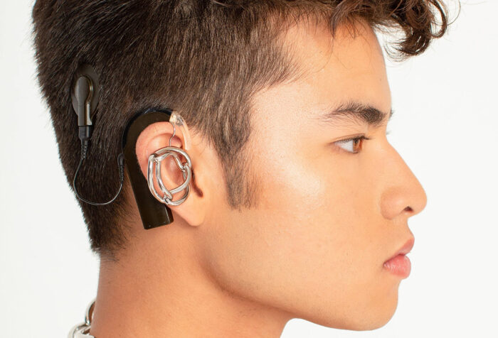 Chella Man's face in profile, hearing aid visible