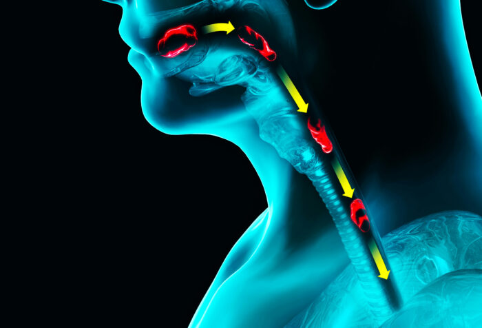 A medical diagram of the swallowing process shows a person's head from profile, their throat muscles working to help them swallow.
